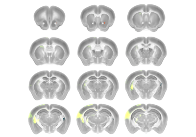 plot_fibers_in_striatum_coronal_view.py
